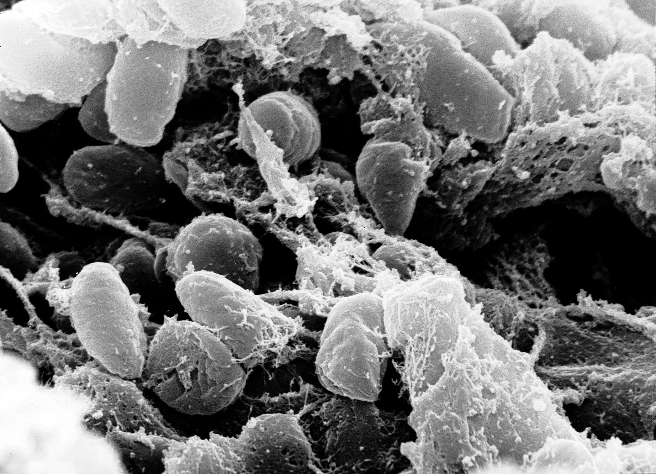 A black-and-white scanning electron micrograph of rod-shaped Yersinia pestis bacteria, the cause of plague, clustered among strands of material.