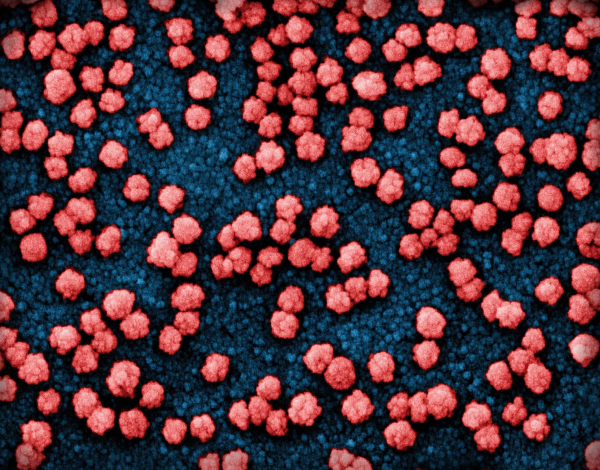Colourised electron micrograph of many round pink virus particles on a blue background.