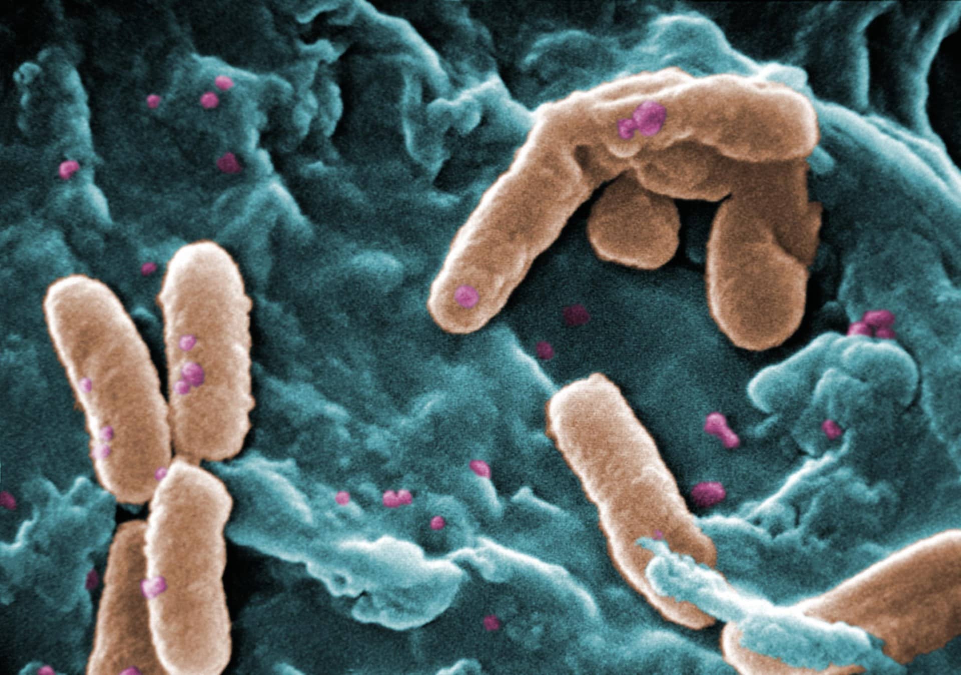 Colourised electron micrograph of orange rod-shaped bacteria on teal tissue-like surface.