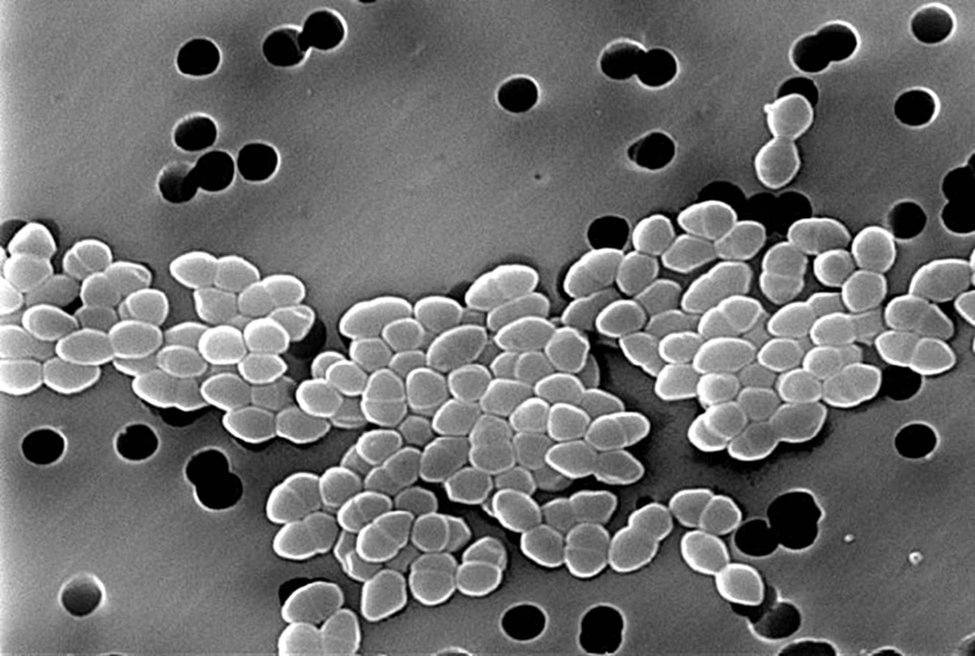 Grey scanning electron micrograph of clustered oval bacteria among filter pores.