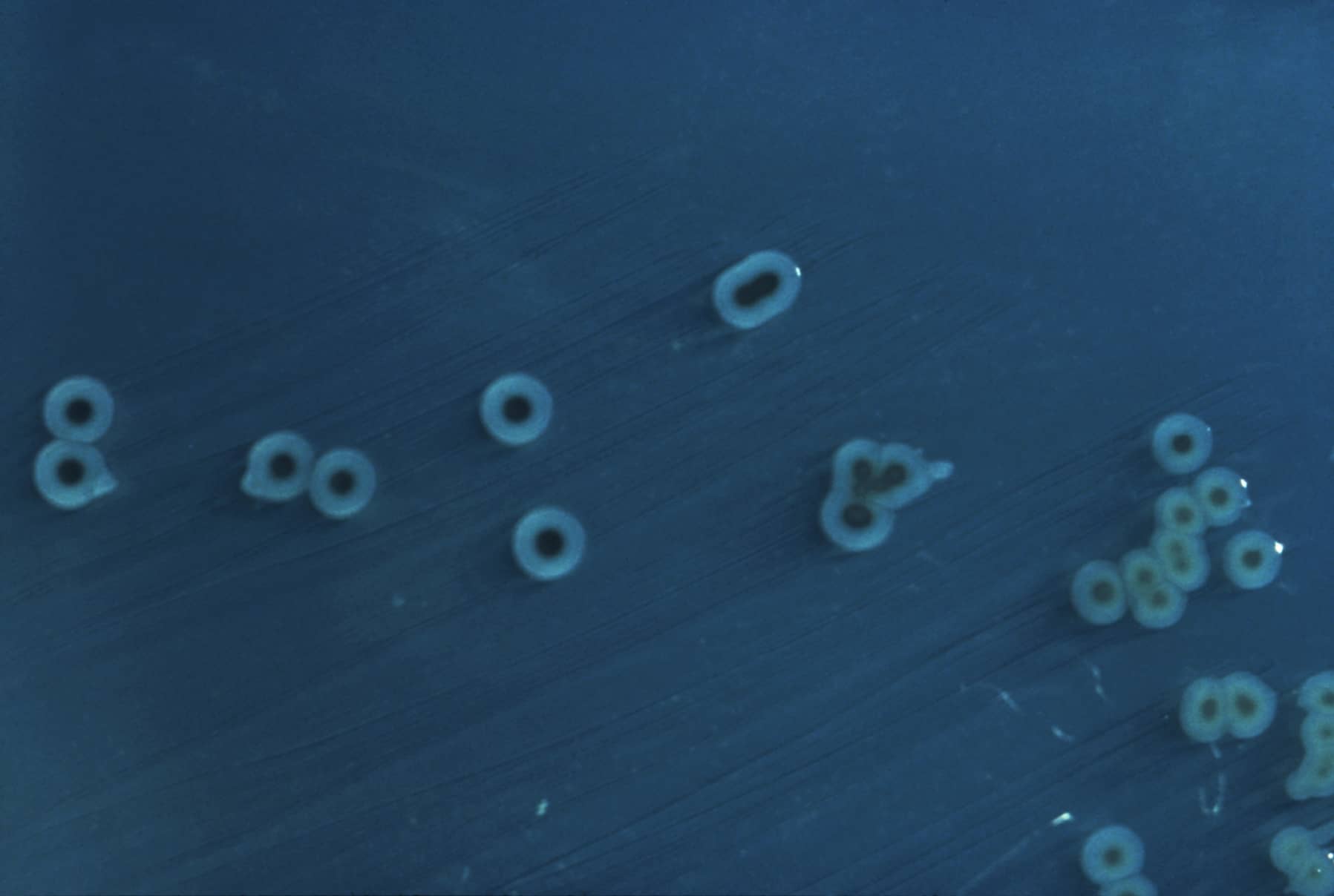 Small ring-shaped bacterial colonies on a dark blue culture surface.