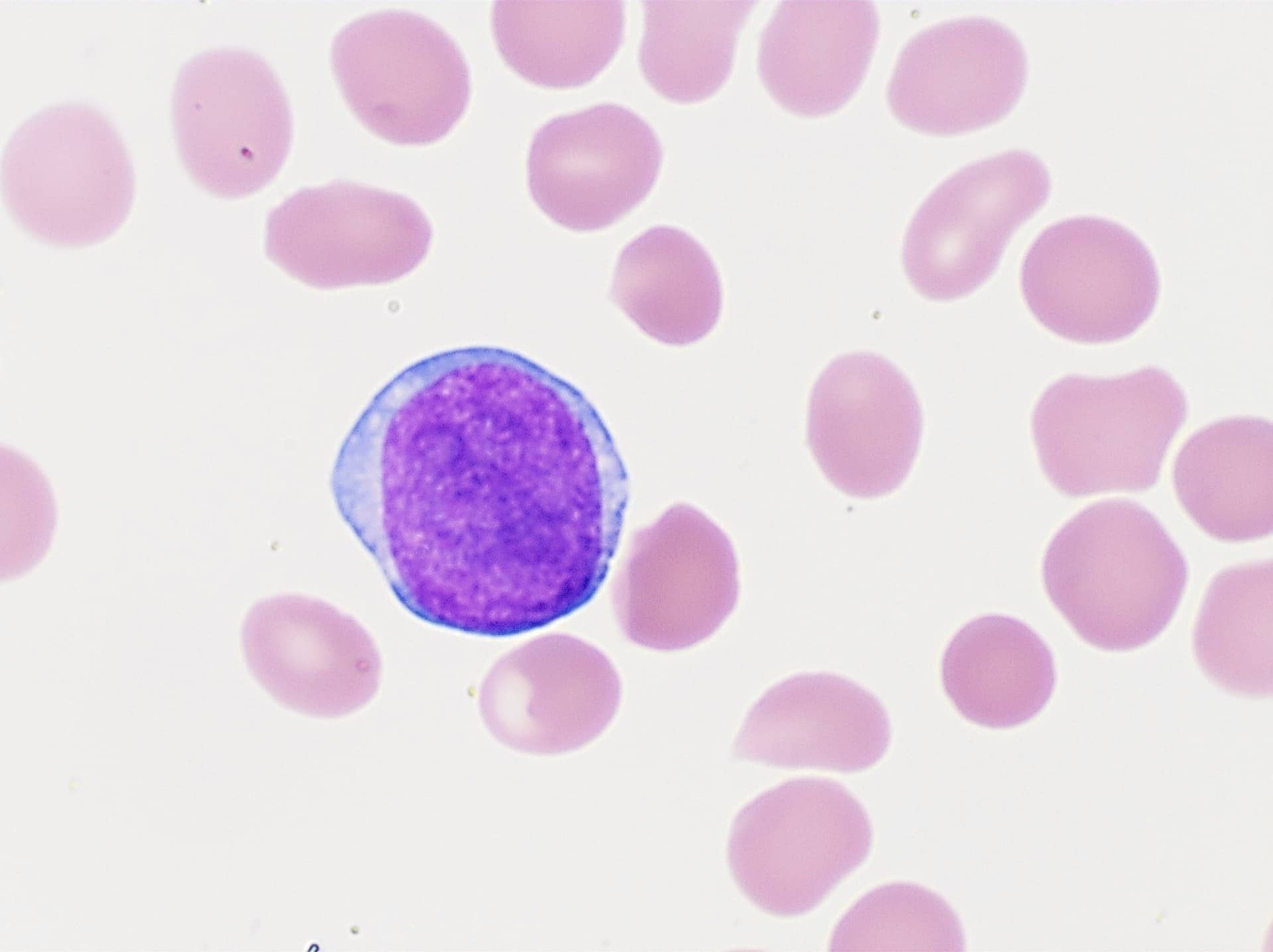 A single stained white blood cell surrounded by red blood cells.
