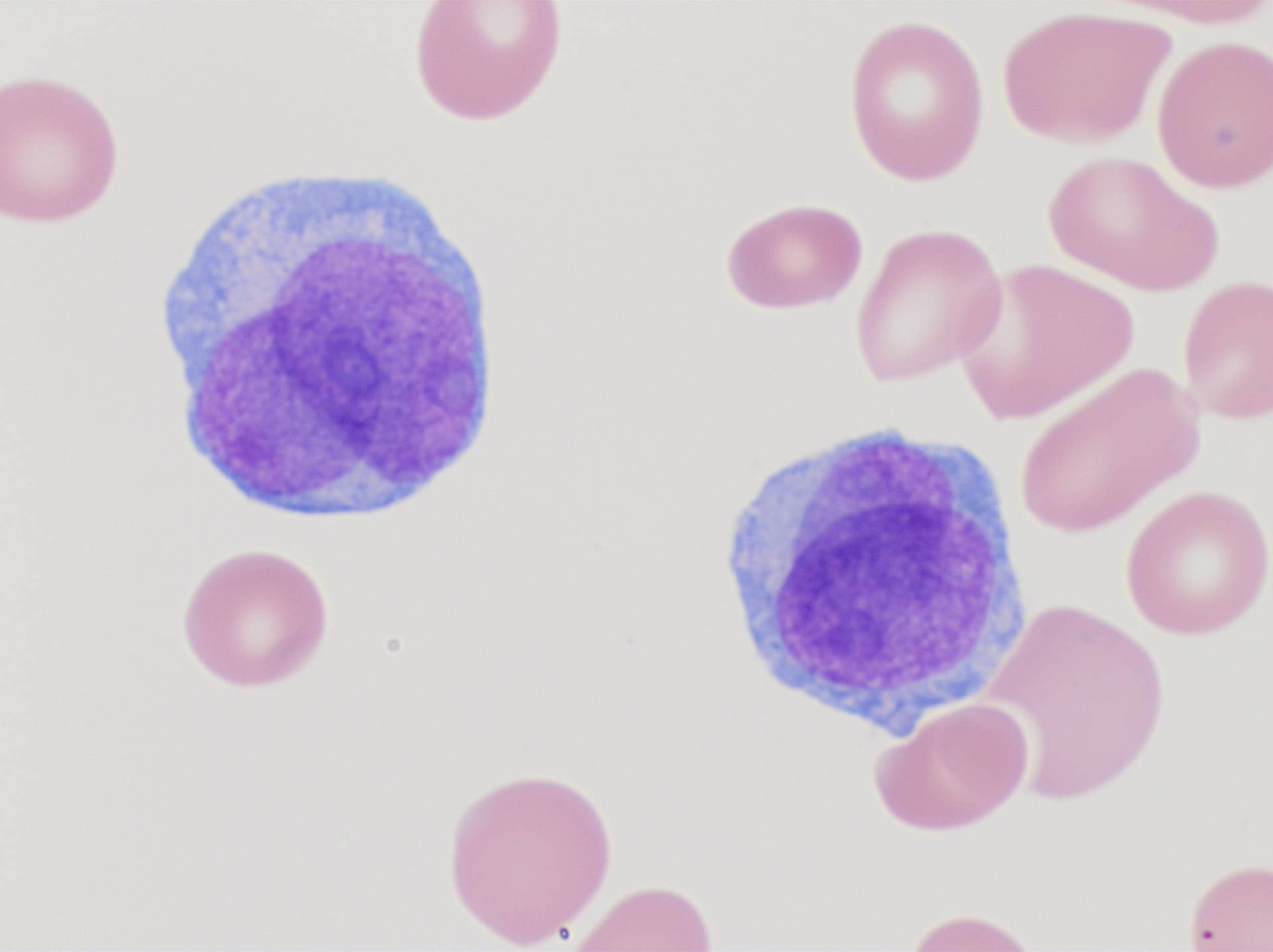 Stained blood smear with two large white blood cells among red cells.