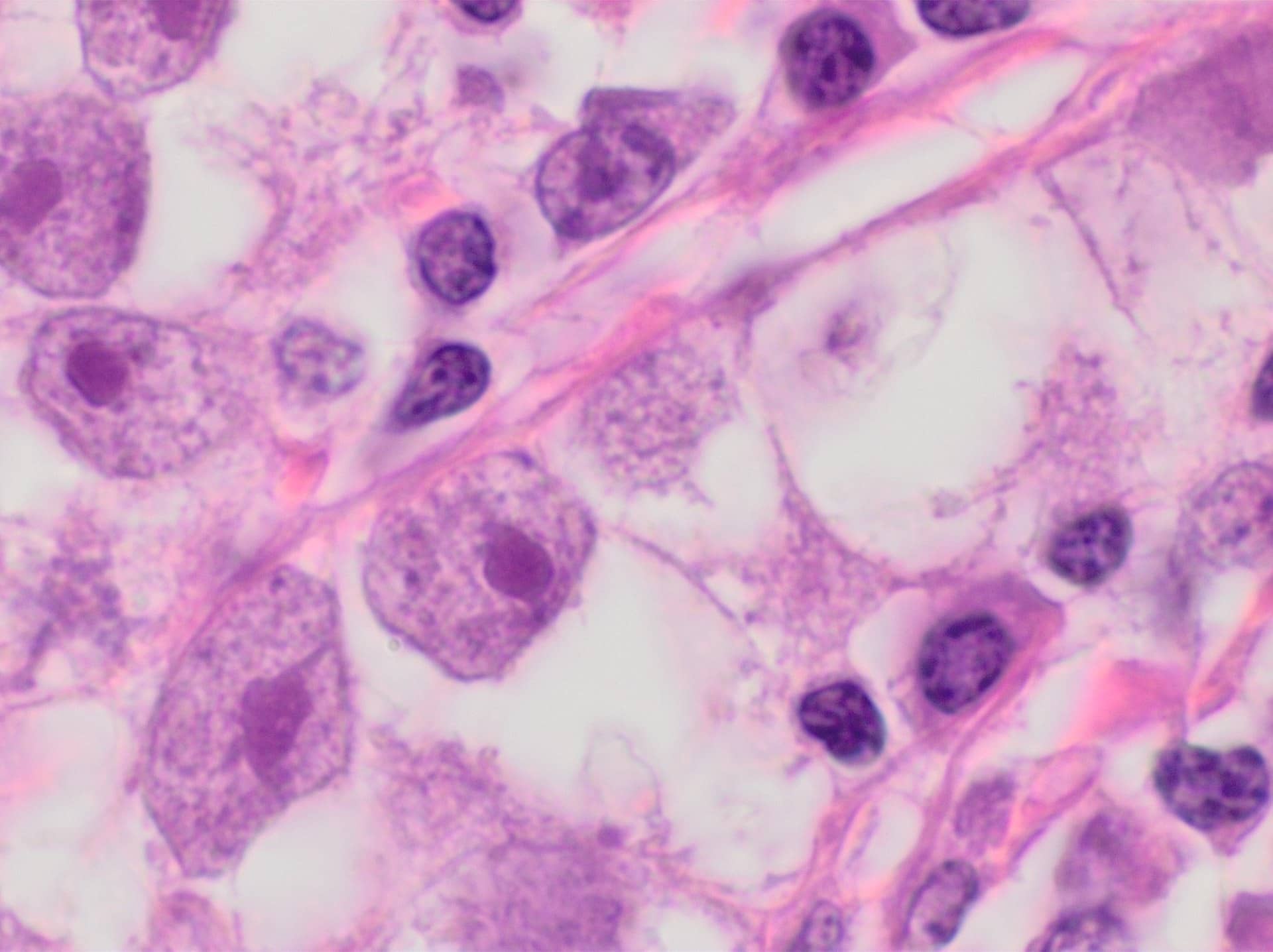 High-magnification microscope view of large stained cells with dark nuclei.