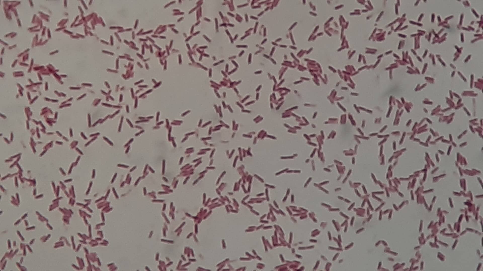 Microscope view of many pink rod-shaped bacteria on a gray background.