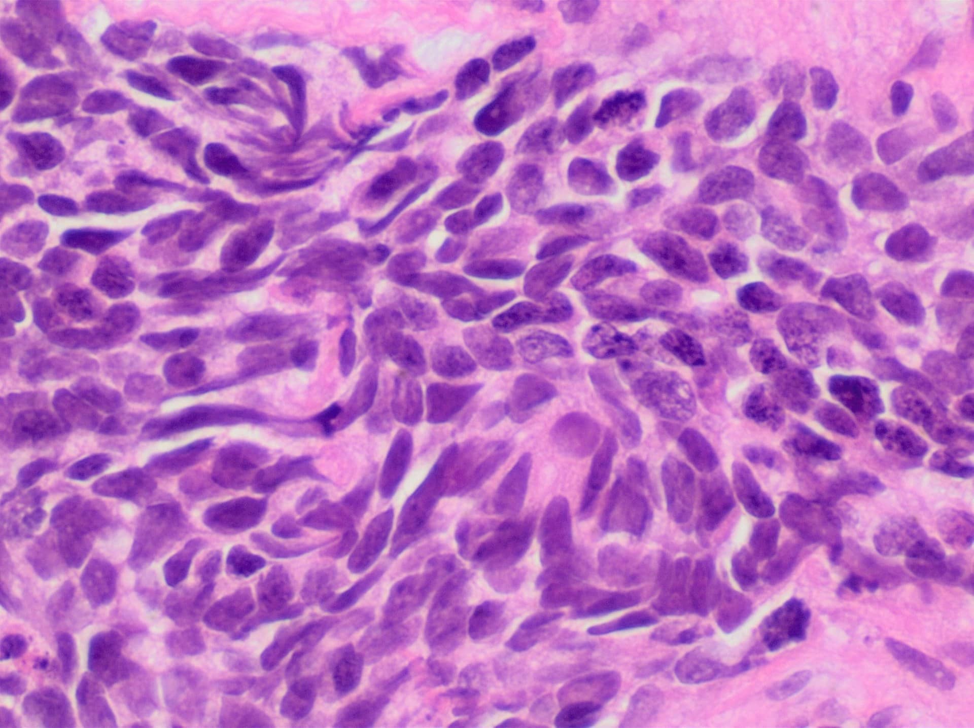 Microscope view of densely packed purple cell nuclei in stained tissue.