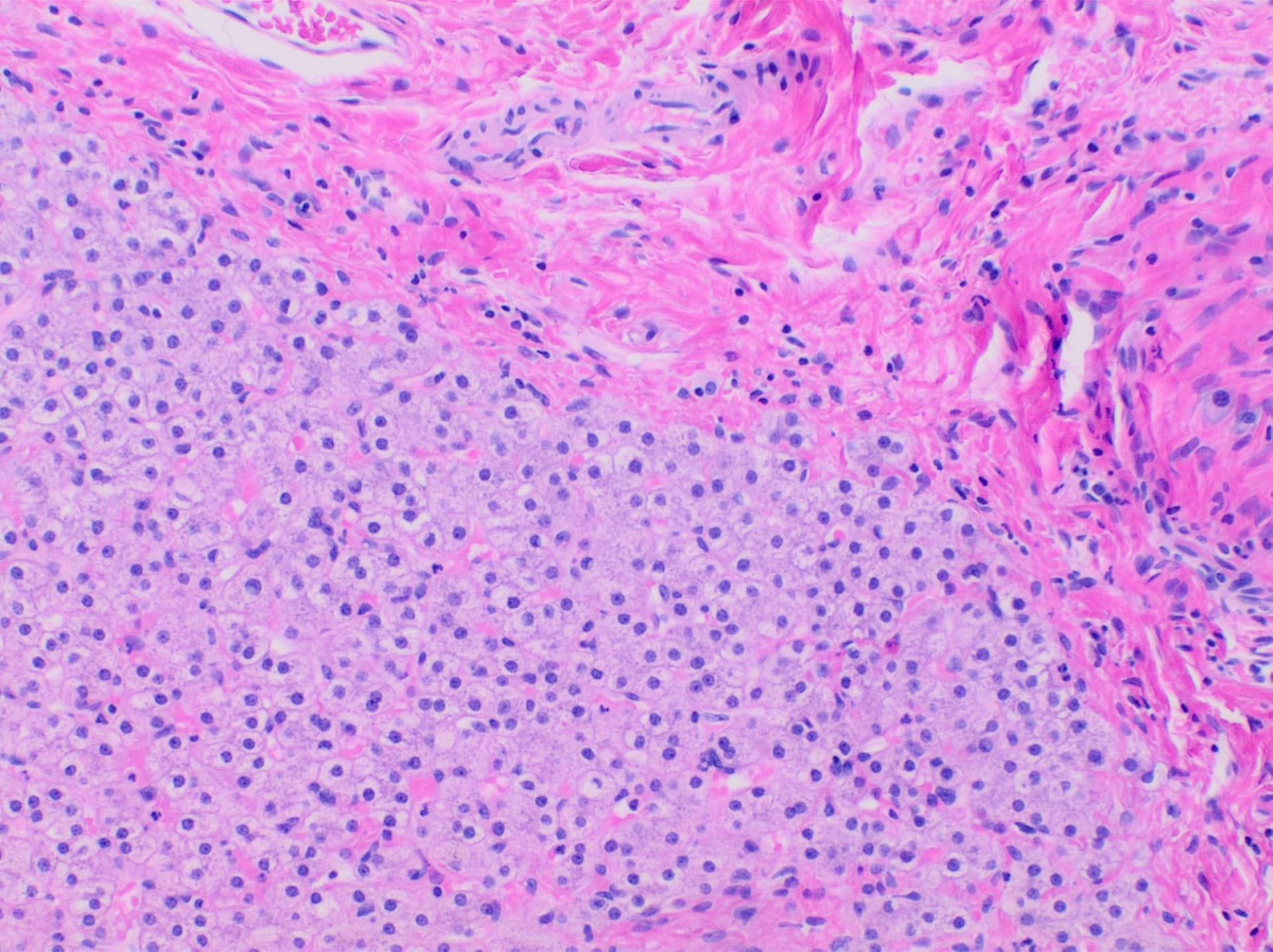 Microscope view of pink and purple stained tissue.