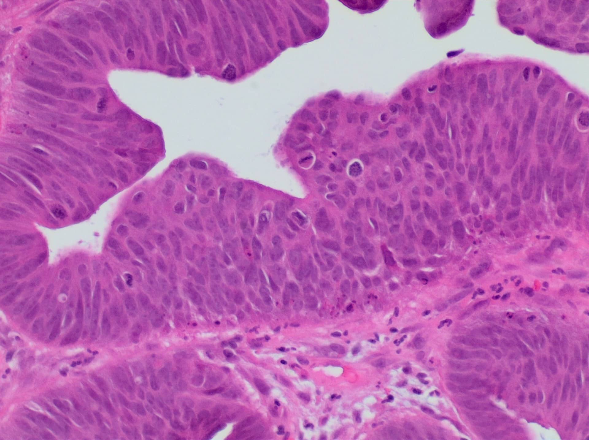 Microscope view of purple-stained tissue with folded glandular structures.