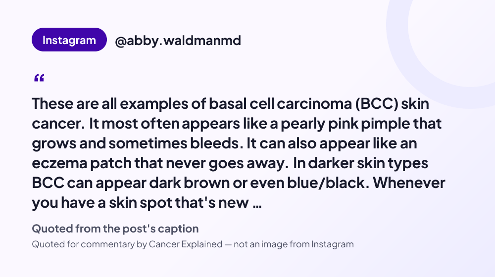 Quote card reading: "These are all examples of basal cell carcinoma (BCC) skin cancer. It most often appears like a pearly pink pimple that grows and sometimes bleeds. It can also appear like an eczema patch that never..." — @abby.waldmanmd
